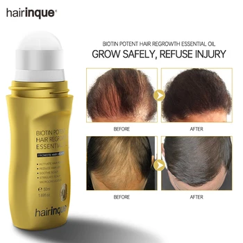 Önlemek Saç Dökülmesi Serum B7 Vitamini Hızlı Saç Büyüme ProductsScalp Tedavileri Büyüyen saç bakım yağı Erkekler için Güzellik Sağlık